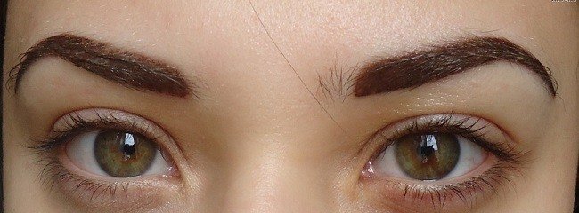 mikroblejding-brovej-pri-beremennosti2