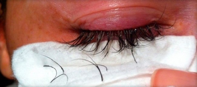 chem-snyat-naroshchennye-resnica-samostoyatelno3