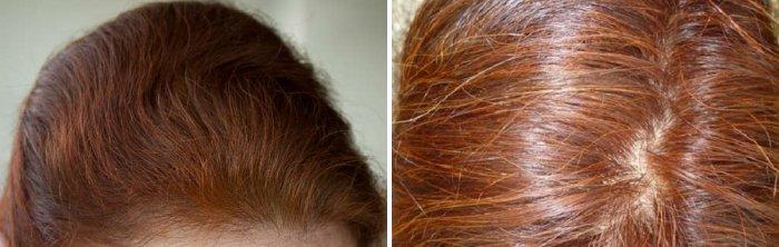 kak-izbavitsya-ot-sediny11