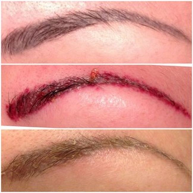 kak-osvetlit-brovi-v-domashnih-usloviyah9а