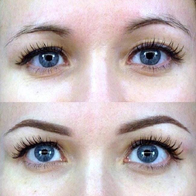 odna-brov-vyshe-drugoj-prichiny-disproporcii1