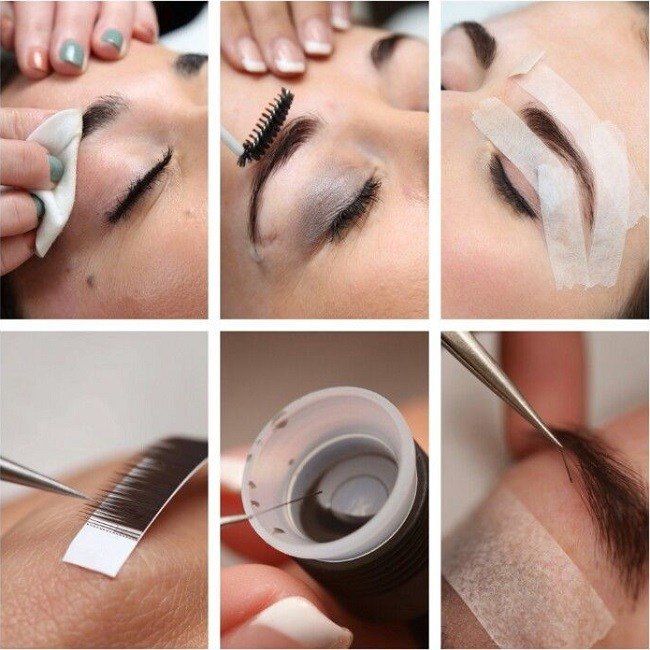 odna-brov-vyshe-drugoj-prichiny-disproporcii10