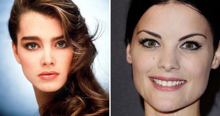 odna-brov-vyshe-drugoj-prichiny-disproporcii4