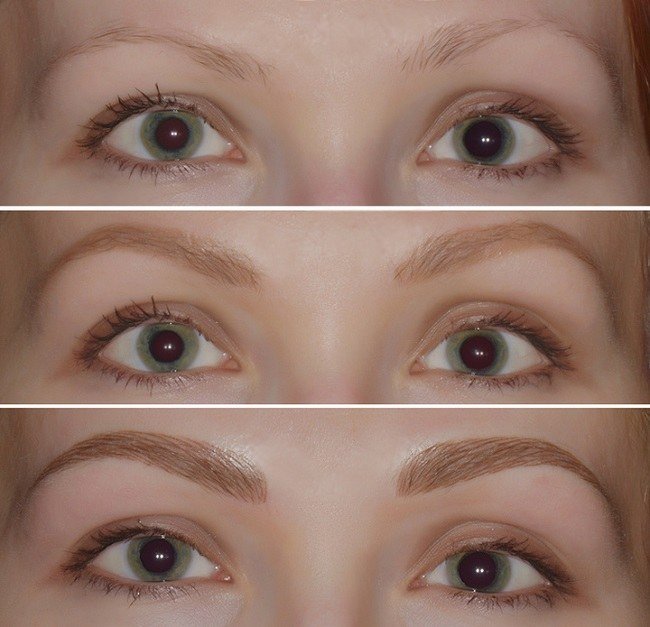 odna-brov-vyshe-drugoj-prichiny-disproporcii8