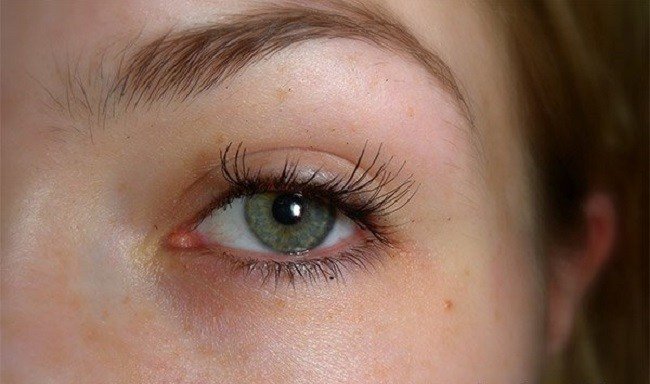 prichiny-vypadeniya-resnic-vozvrashchaem-byluyu-krasotu1