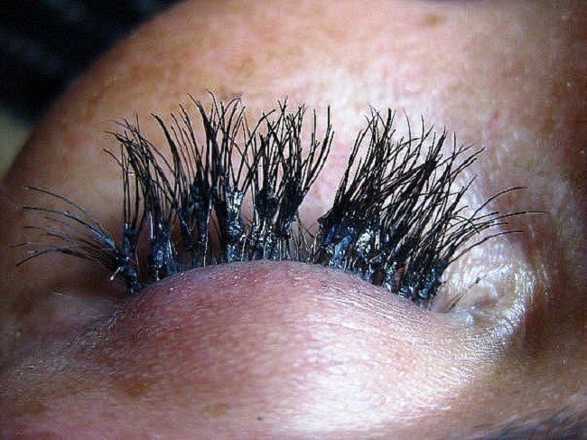 prichiny-vypadeniya-resnic-vozvrashchaem-byluyu-krasotu4