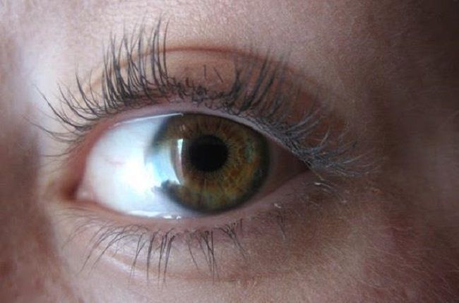 prichiny-vypadeniya-resnic-vozvrashchaem-byluyu-krasotu6