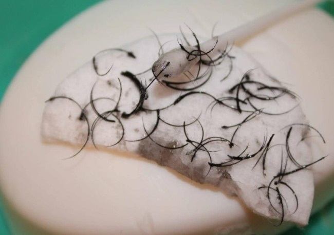 prichiny-vypadeniya-resnic-vozvrashchaem-byluyu-krasotu7в