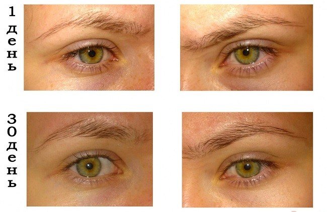 vse-o-nikotinovoj-kislote-dlya-brovej-i-resnic9