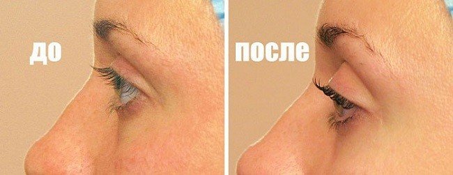 kamfornoe-maslo-dlya-resnic-i-brovej-v-raznyh-recepturah11