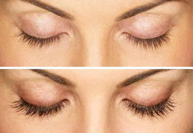 laminirovanie-ili-vosstanavlivayushchij-botoks-resnic11