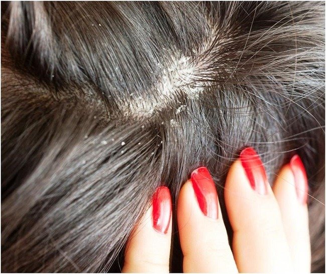 mozhno-li-myt-golovu-i-kak-chasto-hozyajstvennym-mylom11