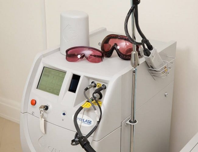 preimushchestva-lazernoj-ehpilyacii-brovej12