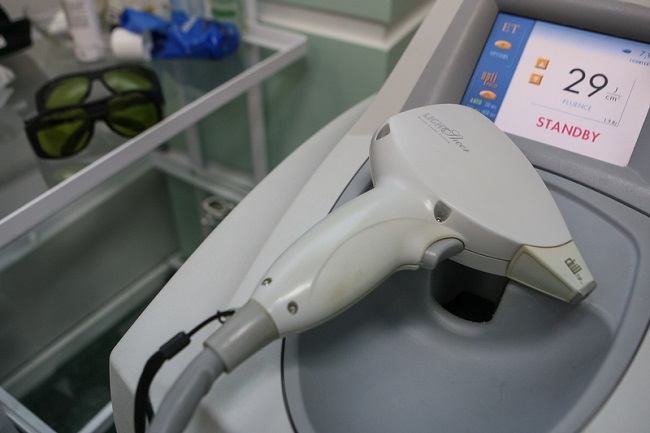 preimushchestva-lazernoj-ehpilyacii-brovej13