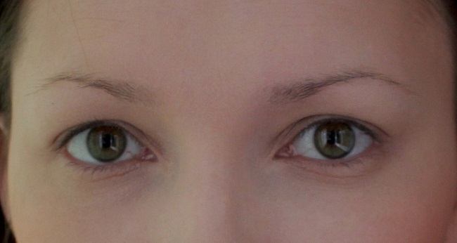 prichiny-i-lechenie-vypadeniya-brovej2