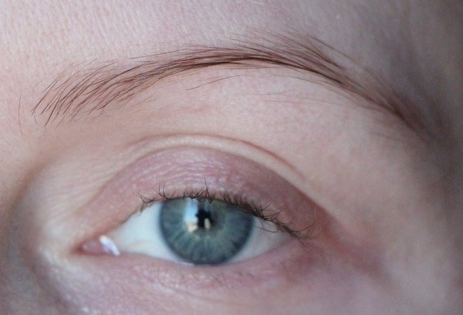 prichiny-redkih-brovej-i-sposoby-ih-vosstanovleniya2