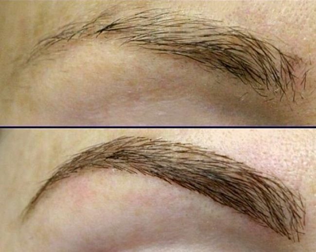 prichiny-redkih-brovej-i-sposoby-ih-vosstanovleniya7