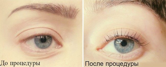 rekonstrukciya-resnic-i-brovej-velvet7