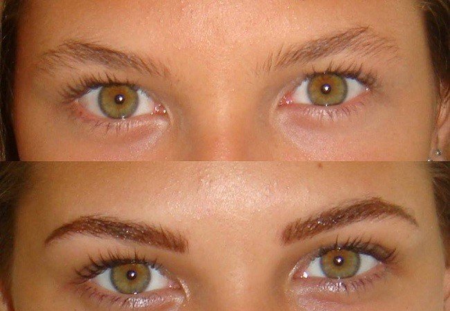 vse-o-procedure-biofiksacii-brovej