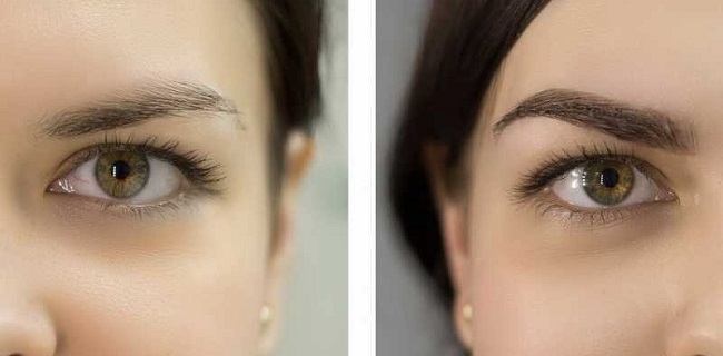 vse-o-procedure-biofiksacii-brovej5