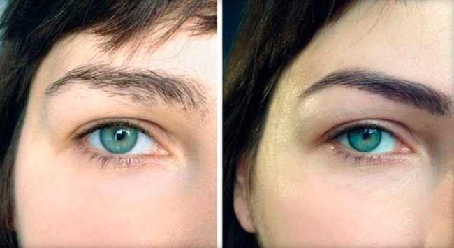 vse-o-procedure-biofiksacii-brovej6