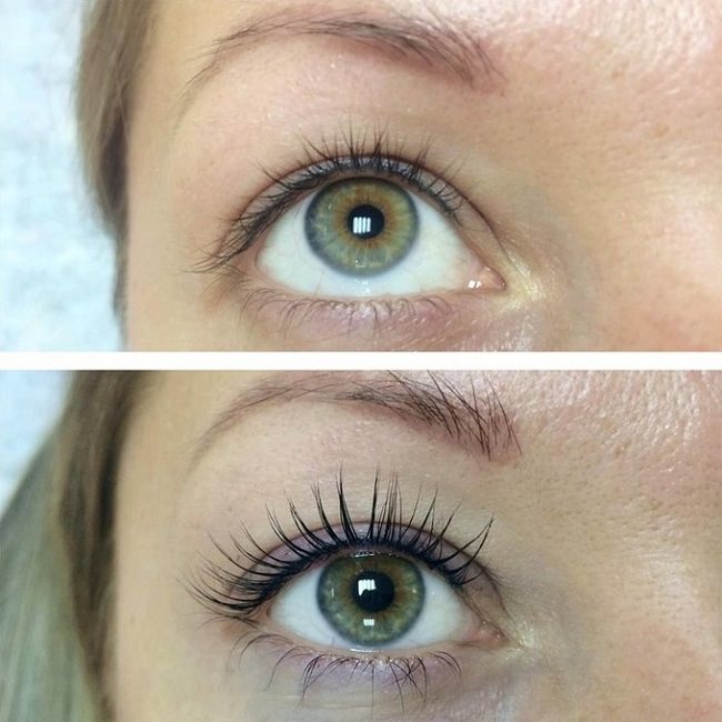 vsyo-o-botokse-dlya-resnic12