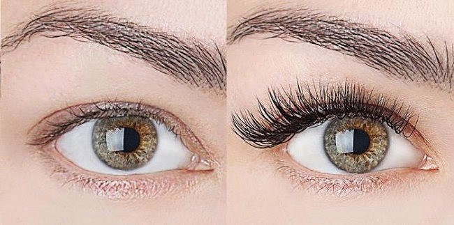 vsyo-o-botokse-dlya-resnic2