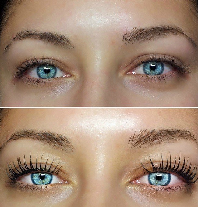 vsyo-o-botokse-dlya-resnic5